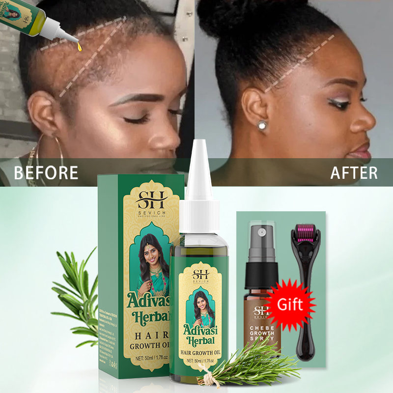 Huile de croissance capillaire - Ingrown Hair Serum avis et prix