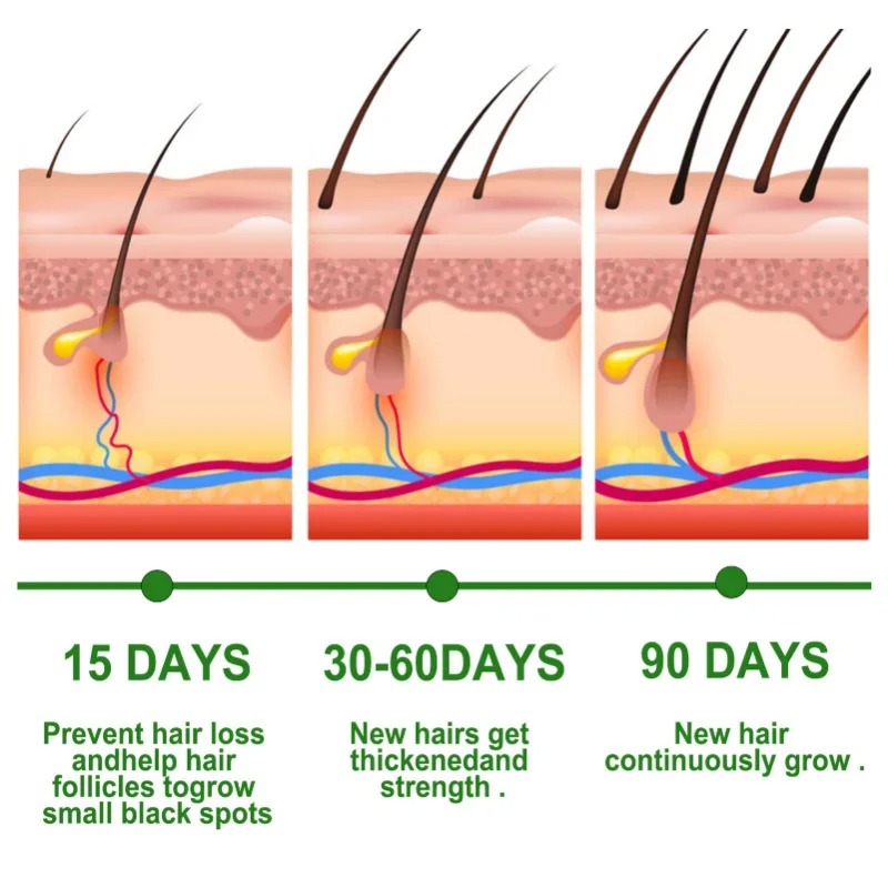 Sérum de croissance des cheveu - Ingrown Hair Serum avis et prix