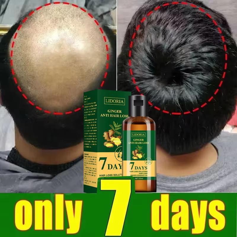 Sérum de croissance des cheveu - Ingrown Hair Serum avis et prix